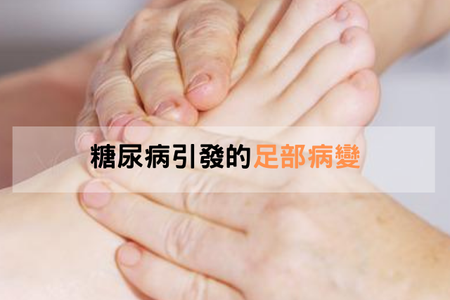 糖尿病引發的「足部病變」