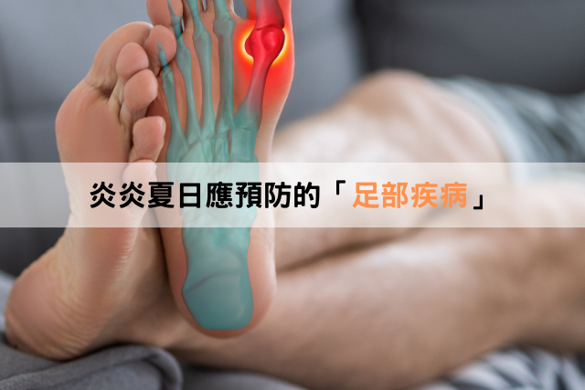 炎炎夏日，別讓足部疾病找上你
