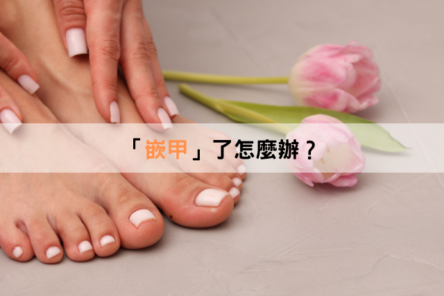 「嵌甲」了怎麼辦？！指甲的平日保養